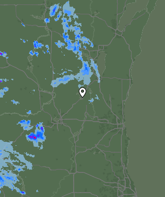 Radar