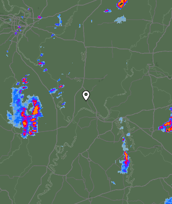 Radar