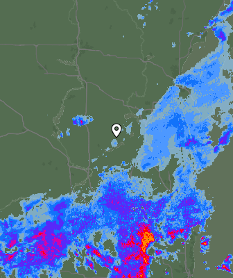Radar