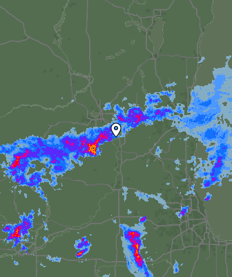Radar