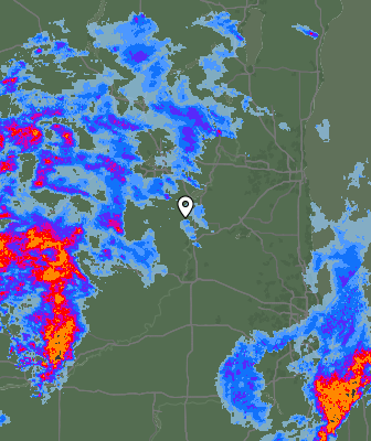 Radar