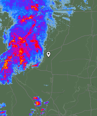 Radar