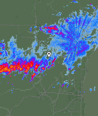 Radar