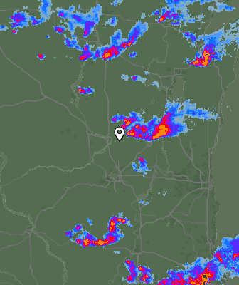 Radar