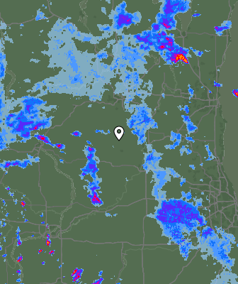 Radar