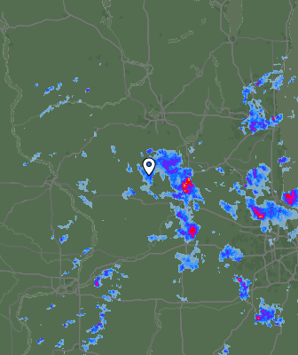 Radar