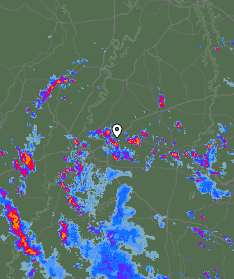 Radar