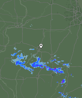 Radar