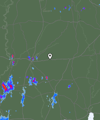 Radar