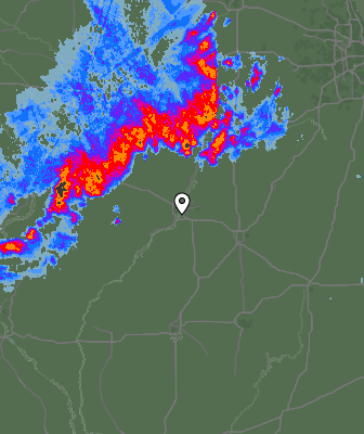 Radar