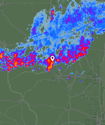 Radar