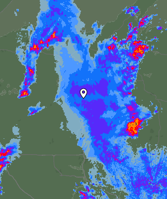 Radar