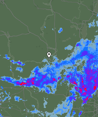 Radar
