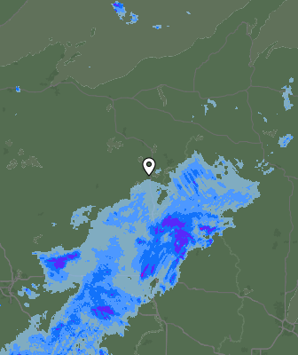 Radar