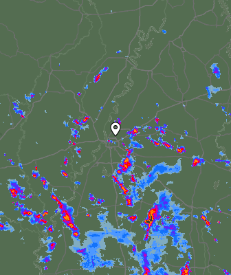 Radar