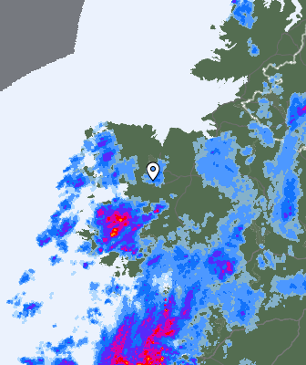 Radar