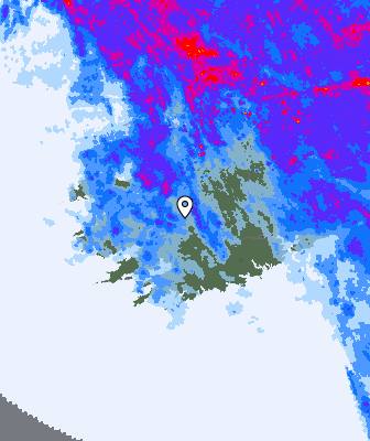 Radar