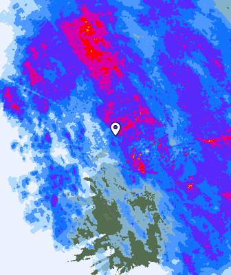 Radar