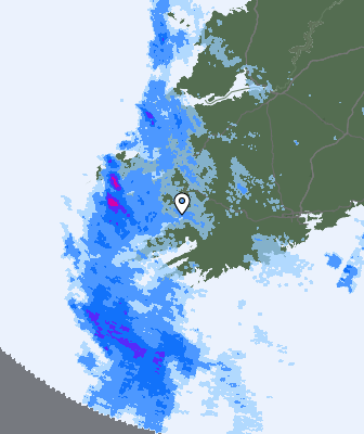 Radar