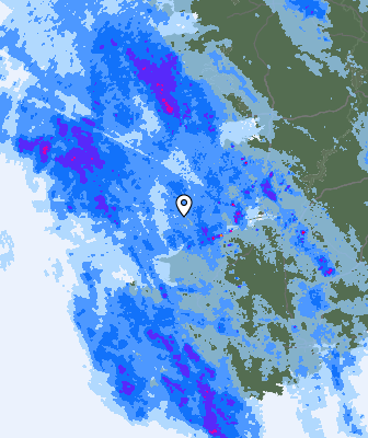 Radar