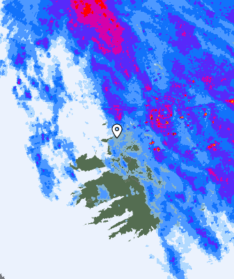 Radar