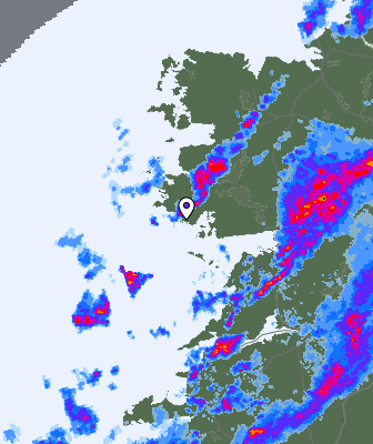 Radar