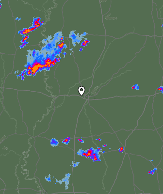 Radar