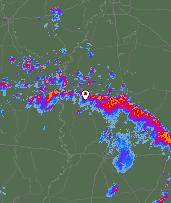 Radar