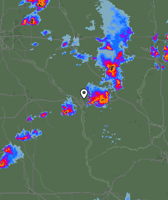 Radar