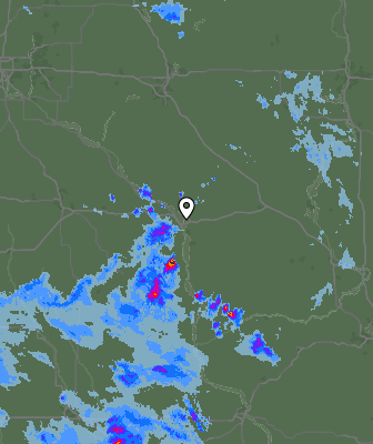 Radar
