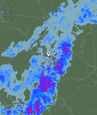 Radar