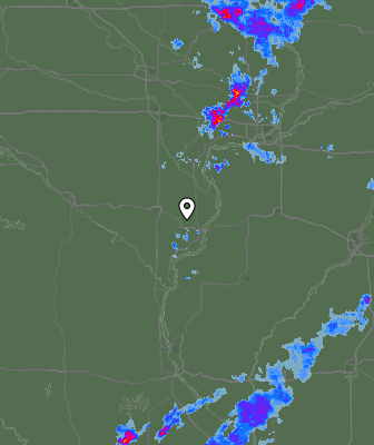 Radar