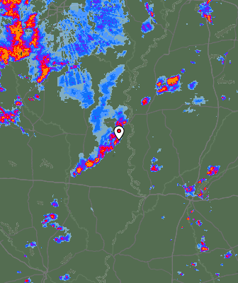Radar