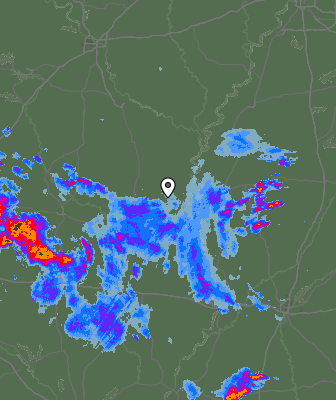 Radar