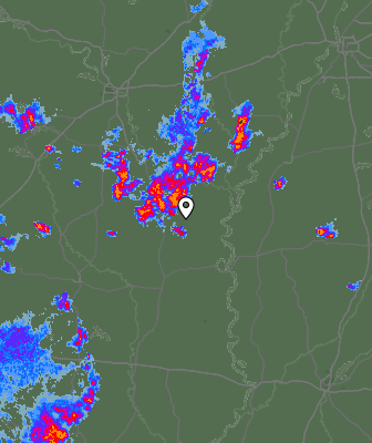 Radar