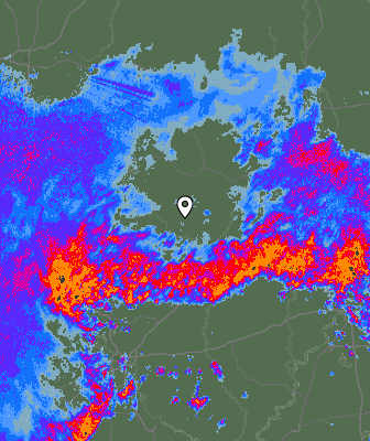 Radar
