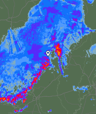 Radar