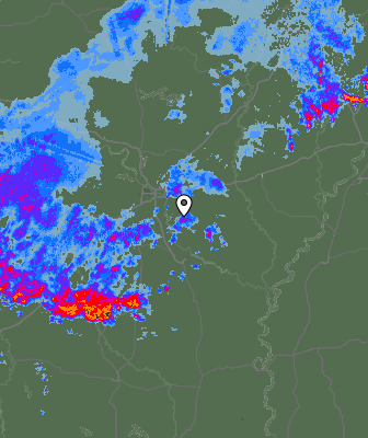 Radar