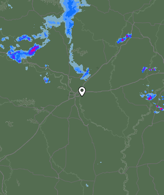 Radar