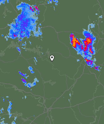 Radar