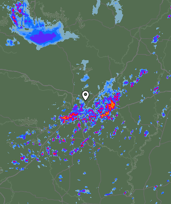 Radar
