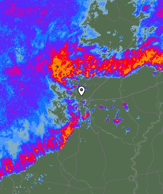 Radar