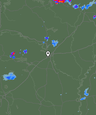 Radar