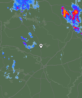 Radar