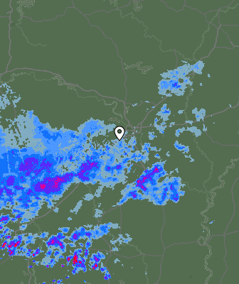 Radar