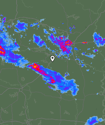 Radar