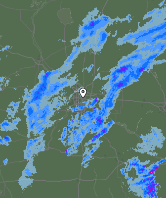 Radar