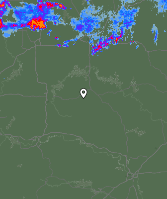 Radar