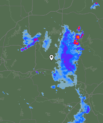 Radar