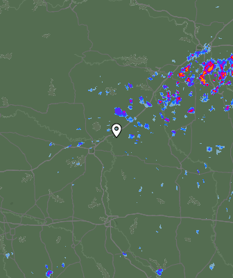 Radar